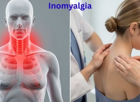Inomyalgia: 9 Natural Ways to Ease the Pain